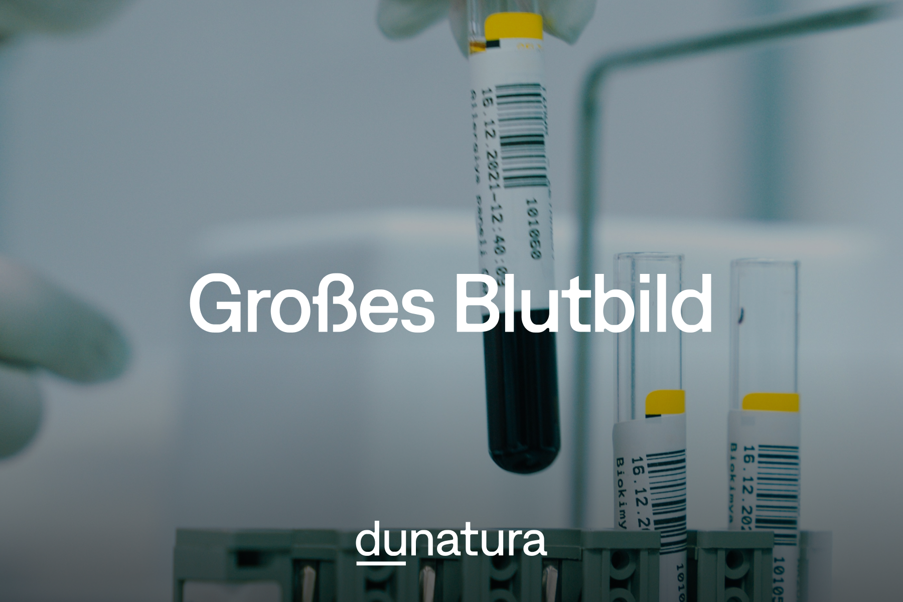 Großes Blutbild beim Arzt: Welche Werte zeigt es - und welche nicht?